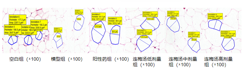 连梅汤对db/db小鼠脂肪细胞异常的调节作用的研究(图1)